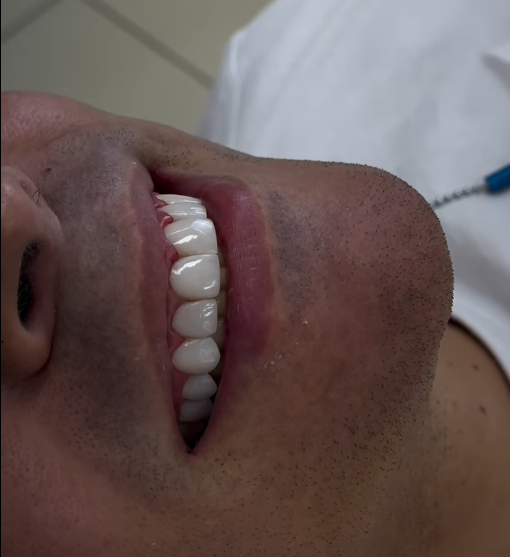 Dentista em Ribeirão Preto - SP